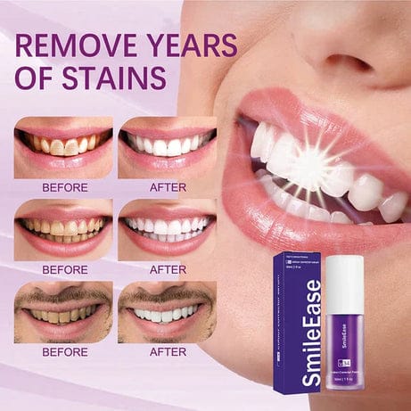 Original HiSmile V34 Teeth Whitening Serum