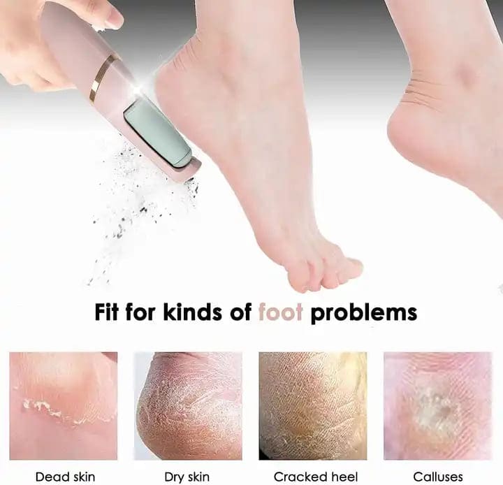 Rechargeable Flawless Electric Foot Callus and dead body Remover - Chic Flicks Store