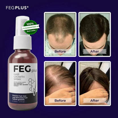 FEG Plus Beard & Hair Growth Serum Spray | 60 ML - Chic Flicks Store