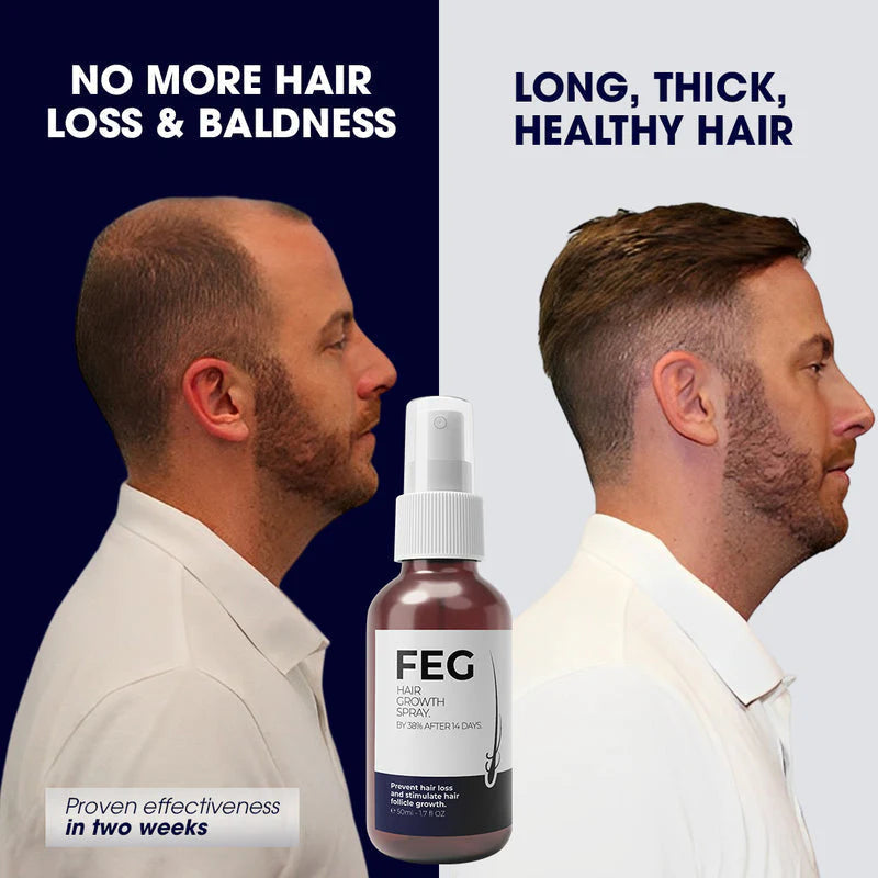 FEG Plus Beard & Hair Growth Serum Spray | 60 ML - Chic Flicks Store